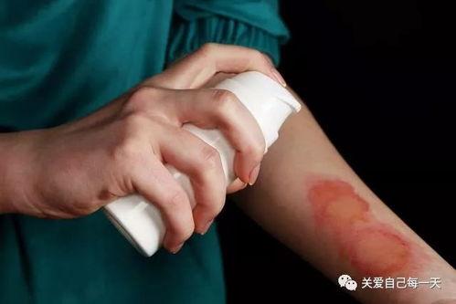 烫伤可以吃胶瓜吗,胶瓜的食疗作用与食用建议